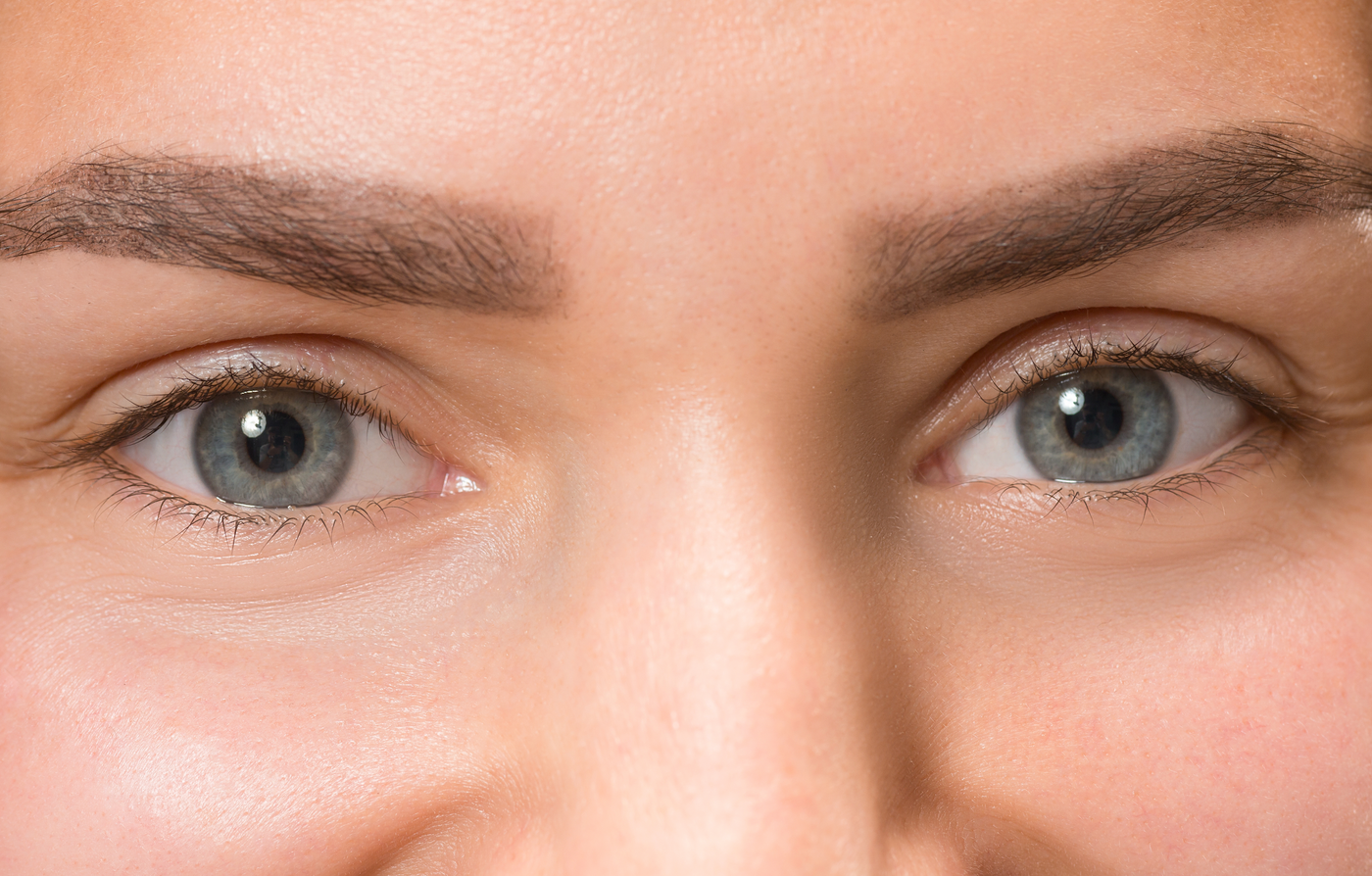 ojos azules con ojeras