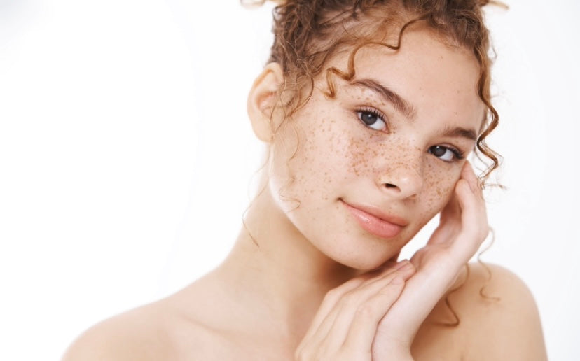mujer joven piel con pecas